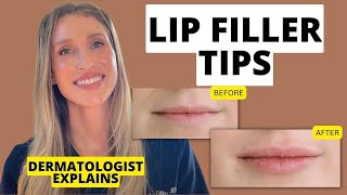 Dermatologist Shares 9 Lip Filler Tips to Know Before and After Treatment [upl. by Llenrup]