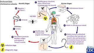 Onchocerca volvulus life cycle [upl. by Stanzel333]