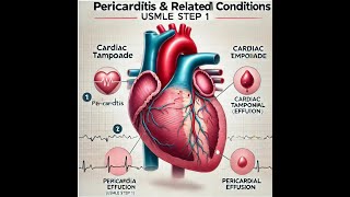 PericarditisCardiac tamponadePericardial effusionUSMLE STEP 1 Review [upl. by Felita]