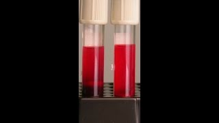 Preventing Hemolysis in the Blood Samples You Draw [upl. by Lewak974]