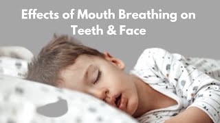 How Does Mouth Breathing leads to Crooked Teeth  Effects of Mouth Breathing on Facial Development [upl. by Marienthal]