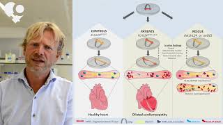 Desmin degradation and dilatation in hiPSCderived engineered heart tissues [upl. by Amolap211]