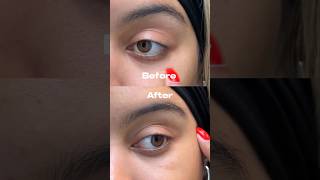 The before and after using the NEW peptide fine line eye gel from Cocokind is INSANEEE🤯 skincare [upl. by Lrem938]