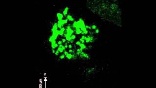 Scientists catch natural killer Tcell attacking disease cell on video [upl. by Ardme]