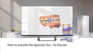 【日本語字幕】ダイナミック・オクルージョン・データをexocadに転送する方法 [upl. by Yrtnej]