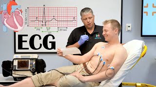 What Is ECG ElectrocardiogramEKG Indications How It Is Done And Basic Principles [upl. by Bonns]