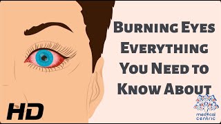 Burning Eyes Everything You Need to Know [upl. by Akina267]