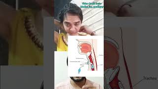 Tracheostomy amp tube youtubeshorts medical [upl. by Uy]