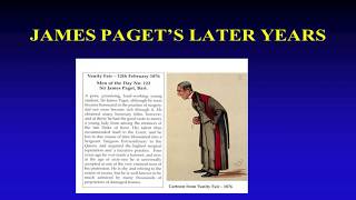 How Pagets Disease got its name and more  the Paget Family [upl. by Davey]