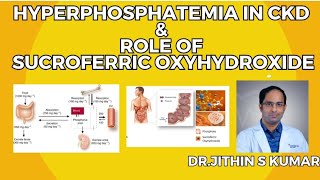 HYPERPHOSPHATEMIA IN CKD amp ROLE OF SUCROFERRIC OXYHYDROXIDE  DRJITHIN S KUMAR [upl. by Akerehs]