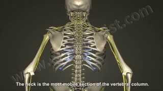 What is Cervical Radiculopathy Disc Bulge Herniation [upl. by Yednarb15]