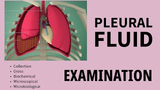 Pleural fluid Examination  Lights criteria  trasudate  exudate [upl. by Gnaig]