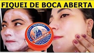 PASSEI NAS RUGAS e FIQUEI DE BOCA ABERTA CLAREEI AS MANCHAS E EXPULSEI PELE VELHA [upl. by Atnoed]