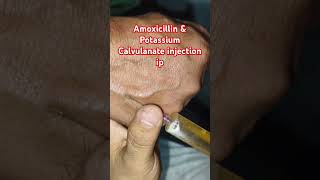 Amoxicillin amp potassium Calvuanate injection ipshrort trending medicalprocedure drxsachin12 [upl. by Harding]