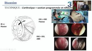 3ème Journée Scientifique du Service de Traumatologie Orthopédie B [upl. by Terpstra]