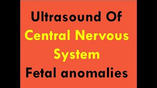 Ultrasound of CNS foetal anomalies [upl. by Kynan]