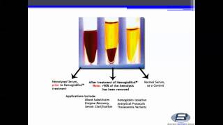 Biotech Support Group HemogloBind™ Hemoglobin Depletion From Hemolyzed SerumPlasma [upl. by Ahsael693]