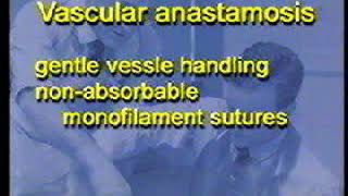 Vascular anastomosis cPsP [upl. by Connett]