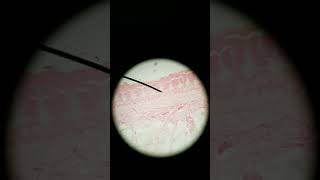 Meissners and Pacinian corpuscle histology [upl. by Brade]