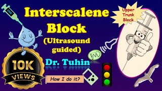 Interscalene Brachial Plexus Block  Ultrasoundguided  Upper Trunk Block  ISB  Anatomy Review [upl. by Thielen]