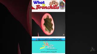 What is Bronchitis I Causes Of Bronchitis I Gaseous Exchange I Biology [upl. by Odnarb]