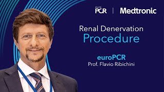 Realworld procedure experience with radiofrequency renal denervation [upl. by Lumbard686]