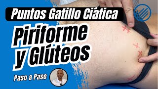 PUNTOS GATILLO Ciática  PIRIFORME y GLÚTEOS Terapia Manual [upl. by Nauqahs]