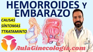 PATOLOGÍA HEMORROIDAL DURANTE EL EMBARAZO Y EL PUERPERIO  Ginecología y Obstetricia [upl. by Anniahs]