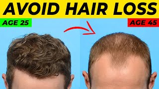 Topical Finasteride For Hair Loss What YOU Need To Know [upl. by Elhsa501]