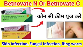 Skin Cream ll Difference between Betnovate N and Betnovate C cream ll How to use Betnovate N ll [upl. by Ynnij]