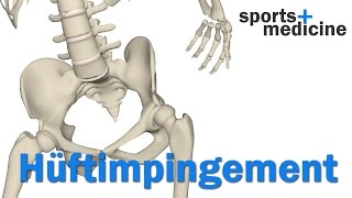 Hüftimpingement  Was ist das femoroacetabuläres Impingement FAI [upl. by Minabe]