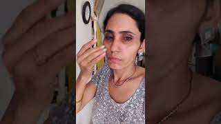 dekho awesome result  How can I remove blackheads at home fast  ghamu saran shorts skincare [upl. by Shandra]