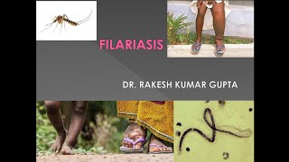 Filariasis cause symptoms diagnosis and treatment [upl. by Ludovick]