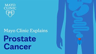 Mayo Clinic Explains Prostate Cancer [upl. by Osner]