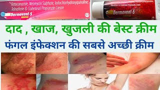 dad ki acchi cream ।। khujli ki cream।। fungal infection ki cream।। dermovent 5 use in hindi [upl. by Hollyanne153]