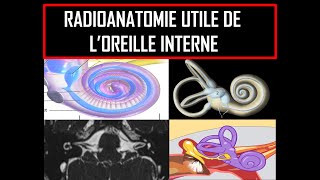 Radioanatomie utile de loreille interne [upl. by Suired]