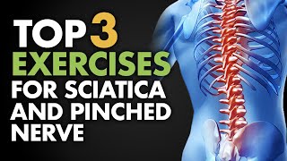 Top 3 Exercises for Sciatica and Pinched Nerve [upl. by Aronal89]