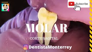 🦷Interior de un DIENTE👅 MOLAR Corte Sagital [upl. by Lunseth]