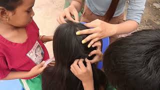 oil hair lice picking in asmr lice hair in dandruff treatment MaChildren [upl. by Alihs]