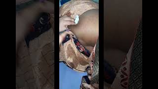 Intramuscular Injection💉Lagane ki Technique  IM Injection💉Kaise lagaye viral iminjection tips [upl. by Alrahs354]