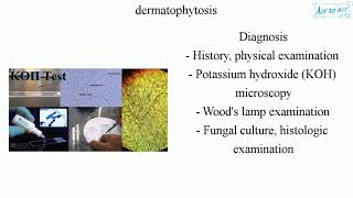 dermatophytosis [upl. by Pennie107]