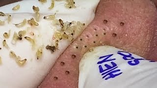 Satisfying video with Hien Nguyen Spa Da Nang 011 [upl. by Barfuss348]