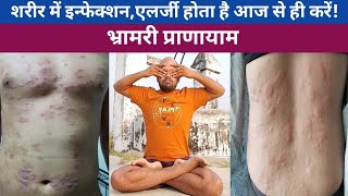 भ्रामरी प्राणायामBhramari Pranayama BenefitsBaba RamdevVijay Yogasan [upl. by Eiramassenav]