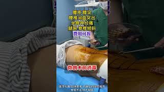 腰椎手术，消毒是第一步 hospital shortvideo [upl. by Miranda]