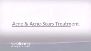 Mediderma Acne amp Acne Scar Treatment On ClickOnCare [upl. by Kinchen]