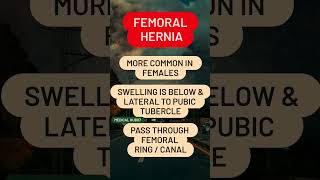 Femoral Hernia [upl. by Lenahc958]