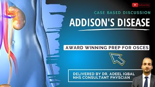 Addisons Disease  Endocrinology  BEST OSCE Preparation for Medical Student Exams [upl. by Luing]