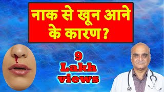 नाक से खून क्यों आता है । Why blood comes from nose । Hindi । डॉ राजीव भाटिया [upl. by Jaymee523]