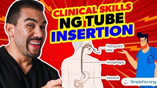 Master NG Tube Insertion A StepbyStep Clinical Skills Guide for Nurses [upl. by Eyaj1]