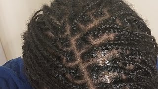 Rosemary Oil Hair Growth Challenge [upl. by Etteloc]